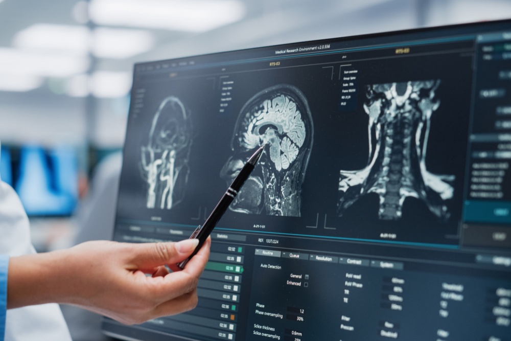 A doctor looking at the results of an MRI scan.